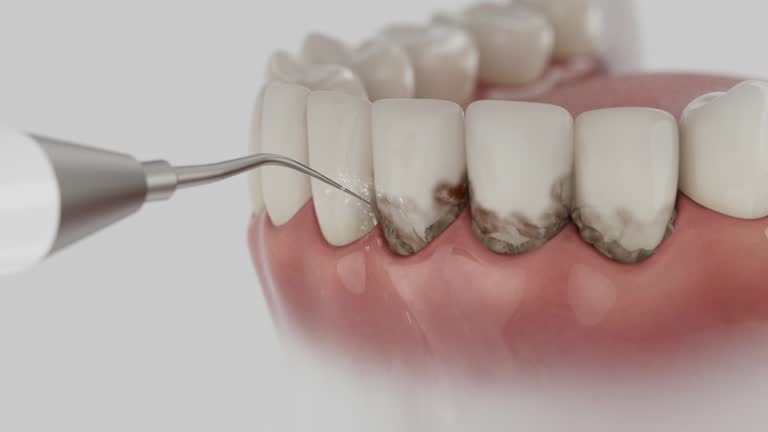 Reliable Dental contractor in Knightstown, IN by Dentist Open Now